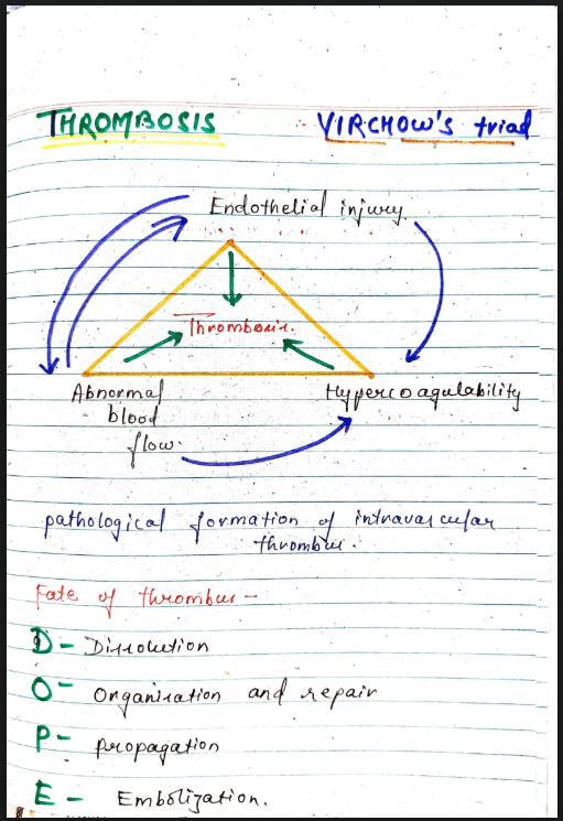 Images of Thrombus Pathology &ndash; MBBS Pathology Notes PDF page - 1