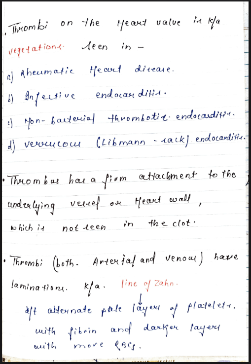 Images of Thrombus Pathology &ndash; MBBS Pathology Notes PDF page - 3

