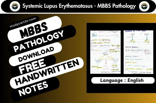 Systemic Lupus Erythematosus (SLE) Notes Download Free