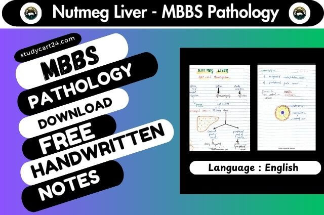 Nutmeg Liver MBBS Pathology Notes Download Free