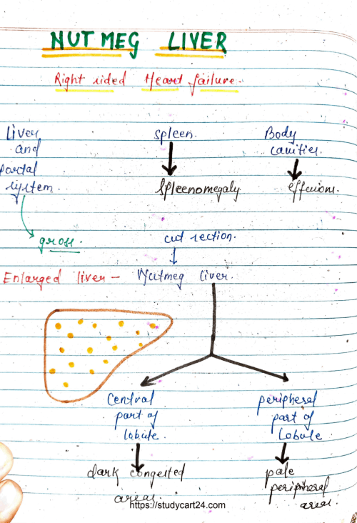 Images of Nutmeg Liver MBBS Notes PDF - Page 1
