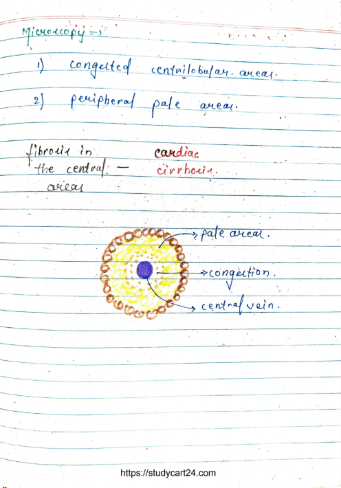 Images of Nutmeg Liver MBBS Notes PDF - Page 3