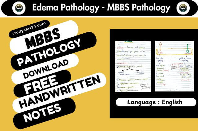 Edema - MBBS Pathology Notes PDF Download FREE